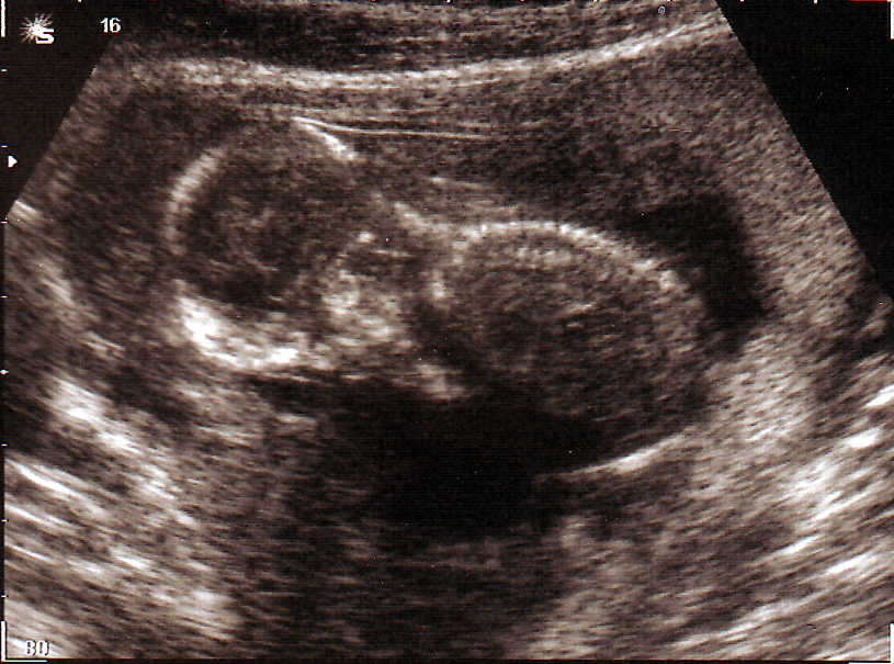 babyscan12.jpg