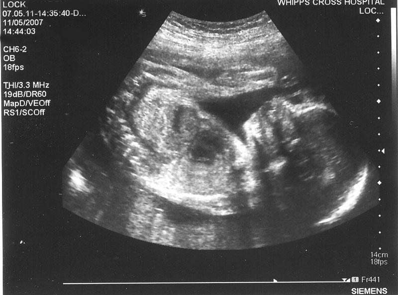 babyscan20.jpg